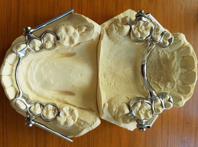 Dental Prosthesis 