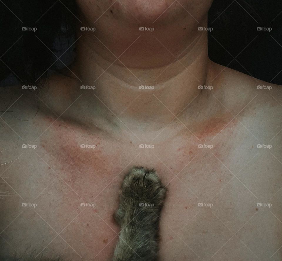 Біль через любов