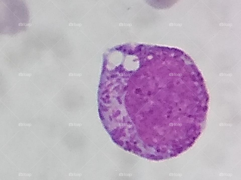 monocitos con vacila en citoplasma