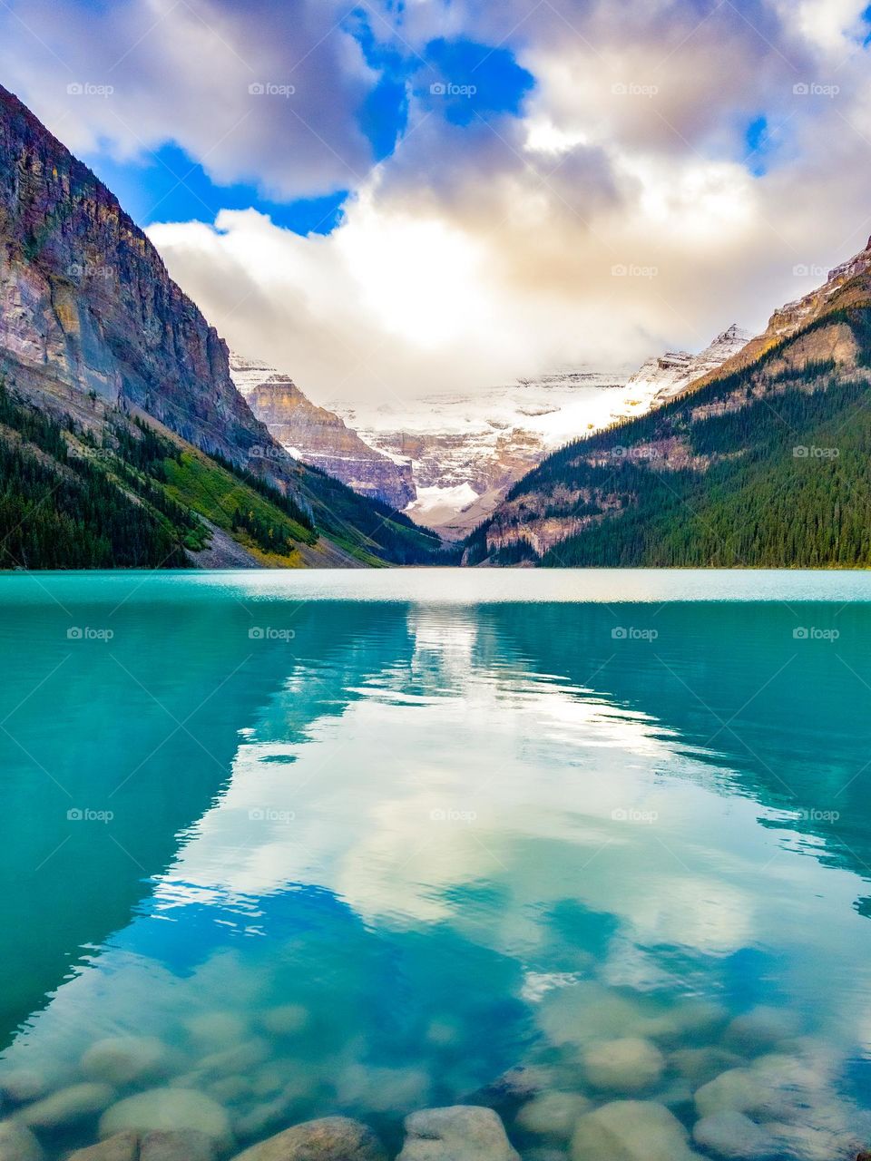 The Mountains That Tower Over Lake Louise