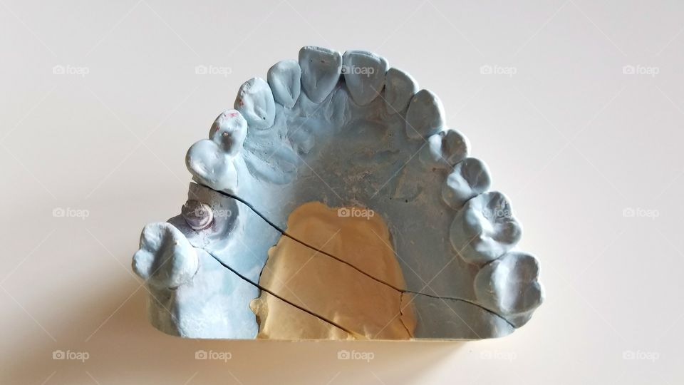 Blue dental teeth impressions