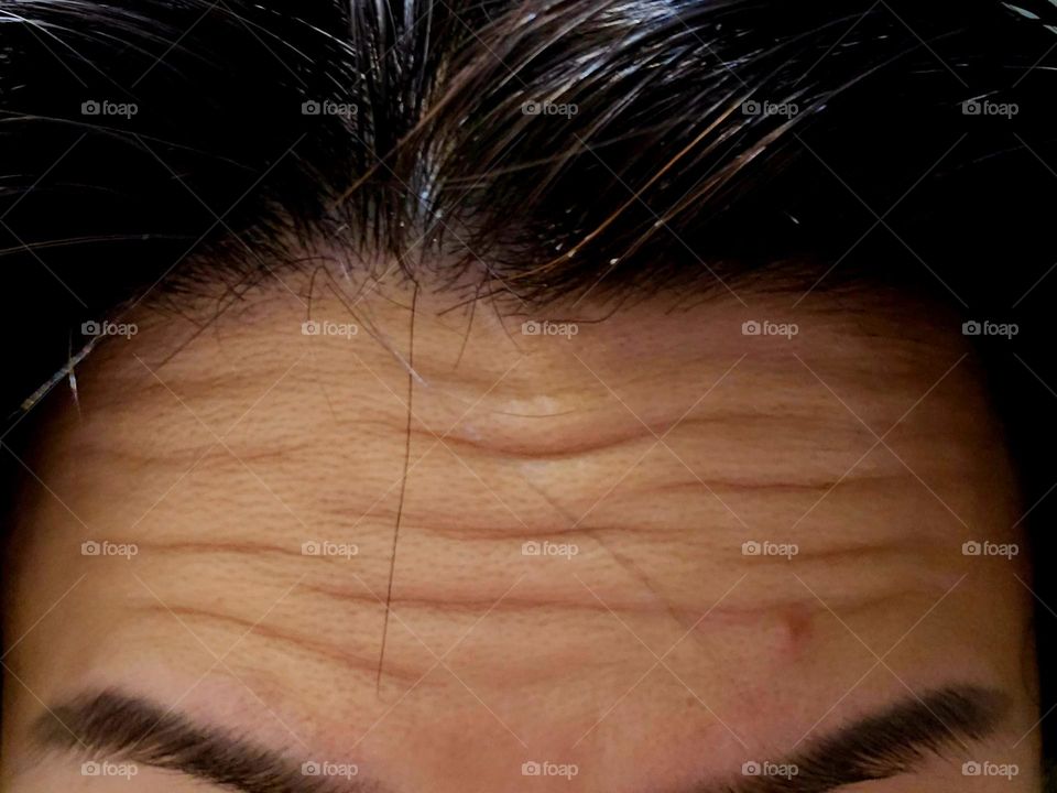 My forehead