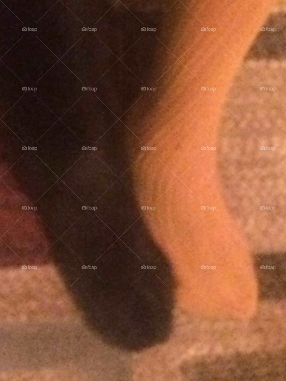 No Person, Medicine, Foot, People, Skin