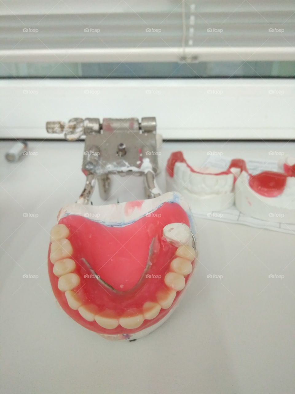 Wax dentures