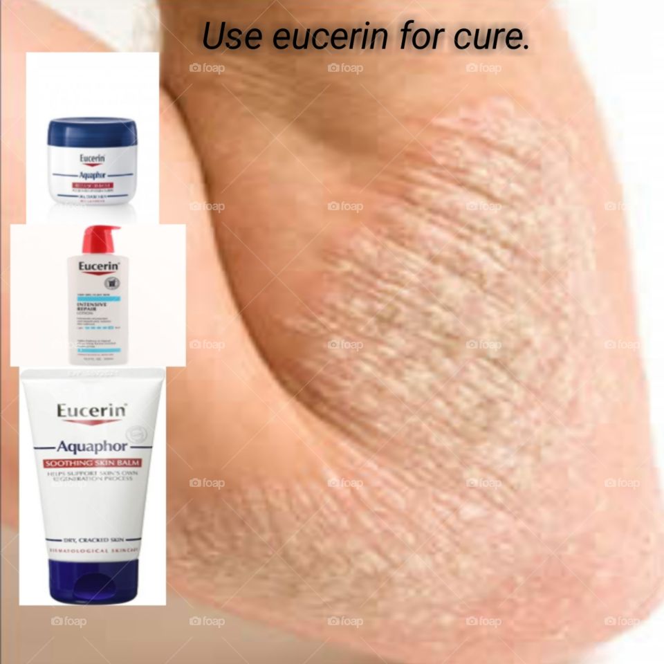 Use eucerin for any skin problems.