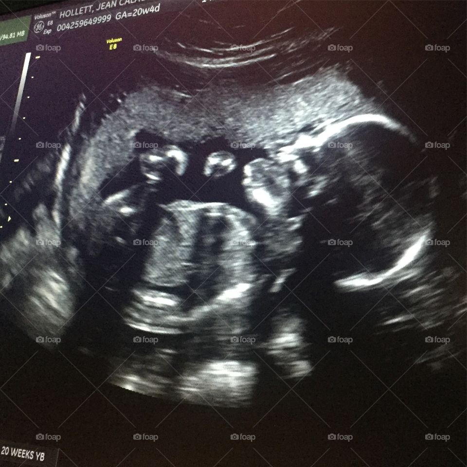 20 weeks baby inside belly