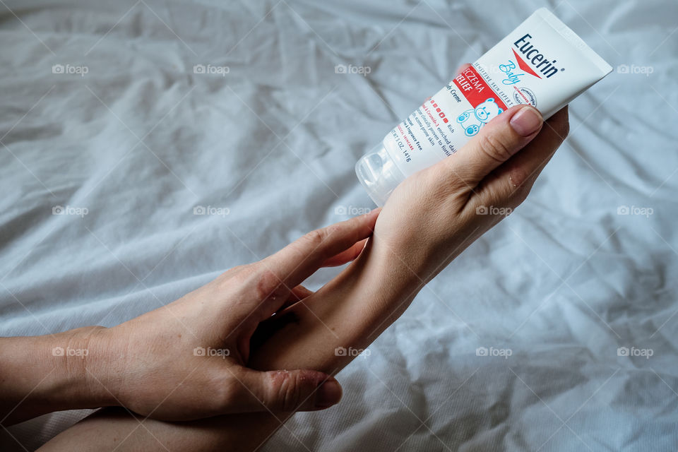 Women's hands with pockets of irritation on the skin hold cream