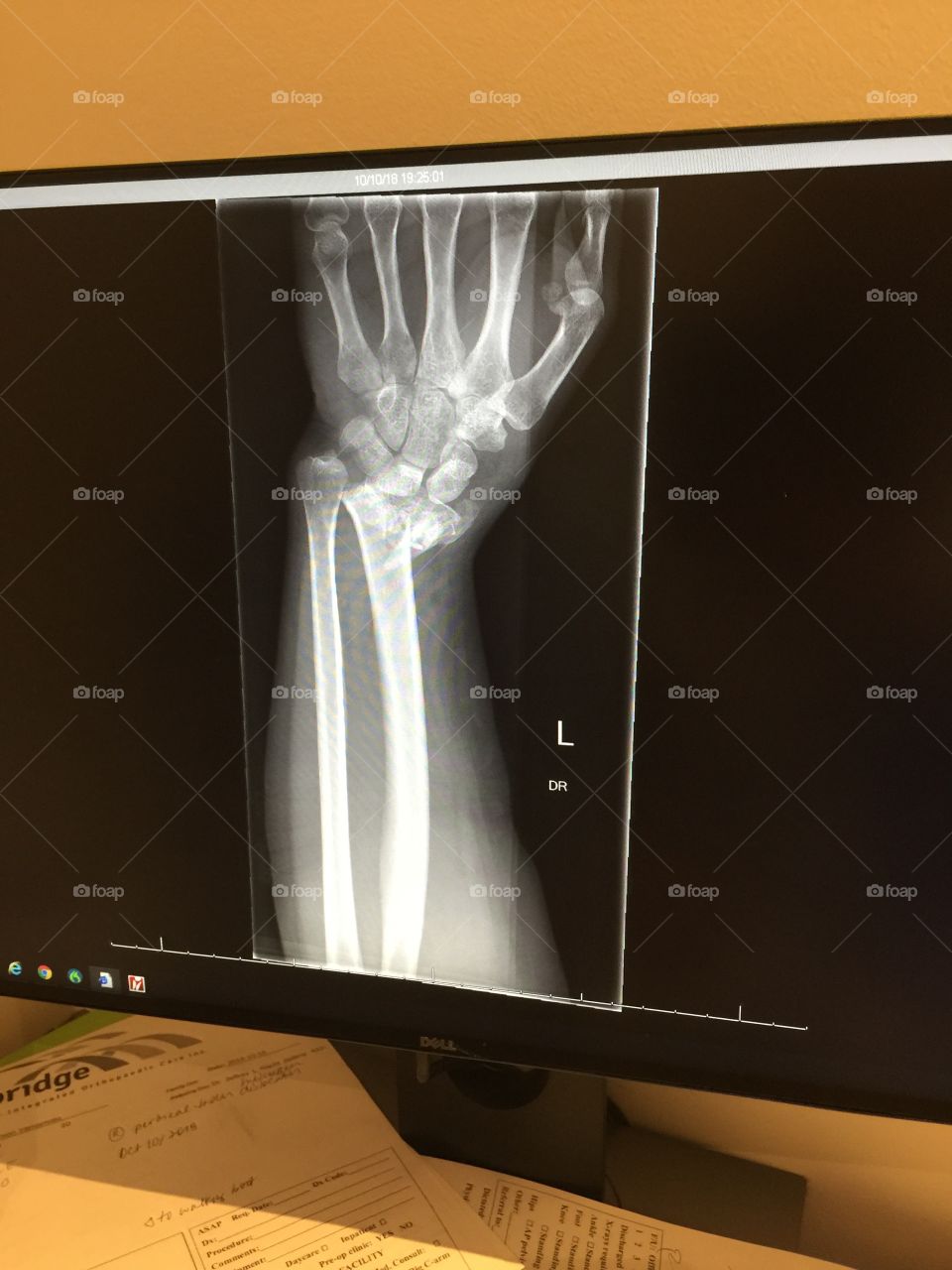 Not a Halloween joke 