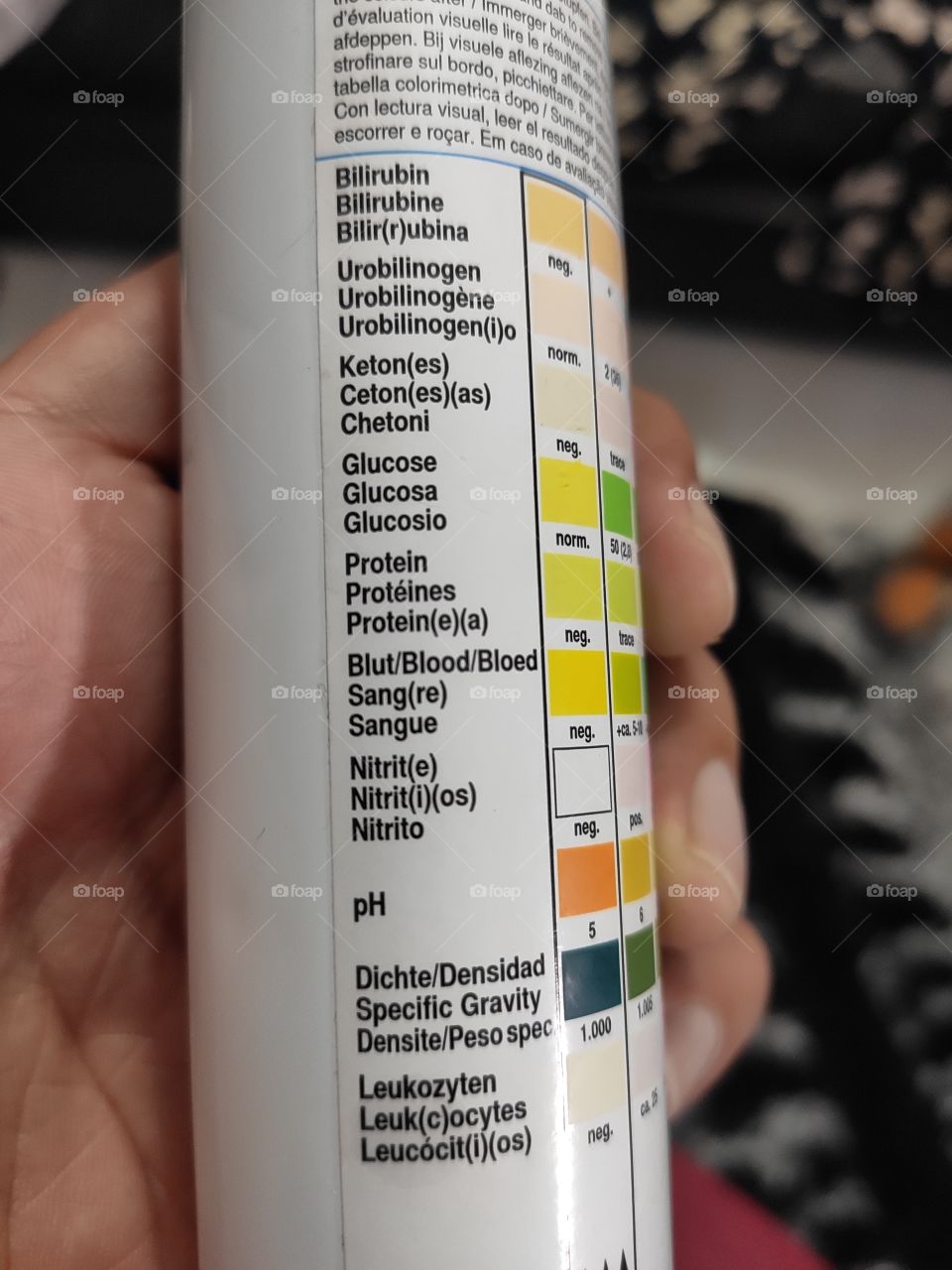 some urine test bars showing ketones and glucose and blood in your urine some protein is a test