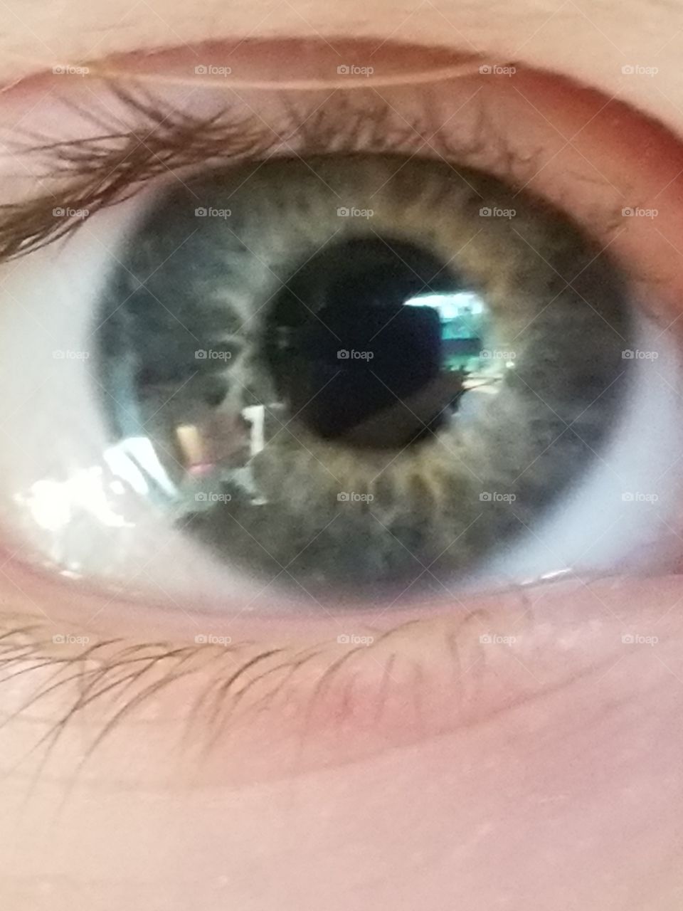 eyeball