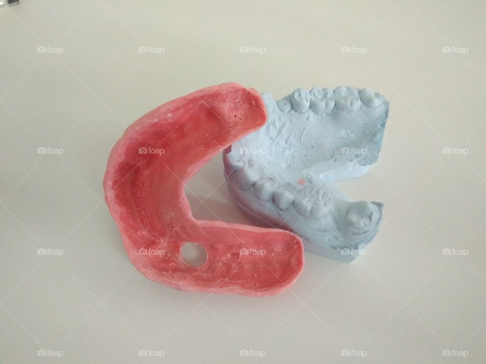 Dental model for implantation